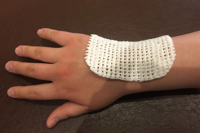 TFCC損傷(手首の小指側の痛み)15歳男性