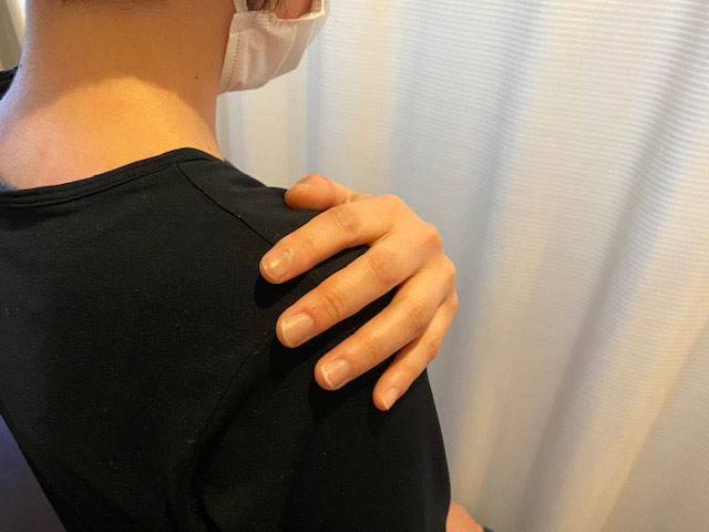肩関節周囲炎　53歳女性